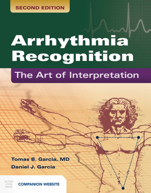 arrhythmia recognition the art of interpretation pdf free download arrhythmia recognition the art of interpretation pdf free download